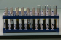 Анализы крови