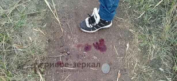 Отправившиеся за грибами подростки нашли в лесу лужи крови