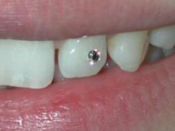 Женщина с бриллиантом в зубе, убитая под Волгоградом, до сих пор не опознана