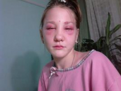 В салоне красоты волгоградке сожгли глаза краской для ресниц В салоне красоты волгоградке сожгли глаза краской для ресниц